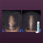 Women's Rogaine 5% Minoxidil Foam for Hair Thinning and Loss 2.11oz - Imperfect Box