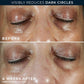 RoC Multi Correxion Even Tone & Lift Eye Cream 0.5 fl oz - Imperfect Box