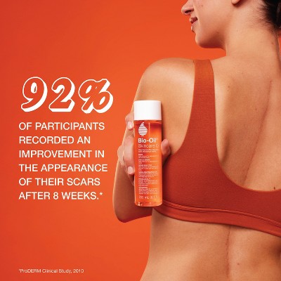 Bio-Oil Body Oil and Scar Treatment with Vitamin E 6.7 fl oz - Imperfect Box