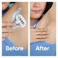 Venus Extra Smooth Sensitive Women's Razor Blade Refills 7ct - Imperfect Box