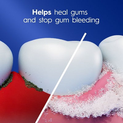 Crest Pro-Health Gum Detoxify Deep Clean Toothpaste 4.8oz - Imperfect Box