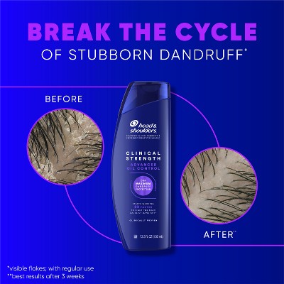 Head & Shoulders Clinical Strength Anti-Dandruff Citrus 13.5 fl oz - Imperfect Container