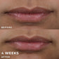 RoC Derm Correxion Lip Volumizer Treatment 0.34 fl oz - Missing Box