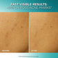 L'Oreal Paris Bright Reveal Dark Spot Exfoliant Peel - Missing Box