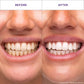 Hismile V34 Teeth Whitening Strips 14pk - Missing Box