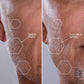 Spa Sciences SIMA Deluxe Sonic Dermaplaning Tool for Exfoliation & Peach Fuzz Removal - Imperfect Box