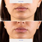 BioRepublic SkinCare Lip Masks 6pk - New